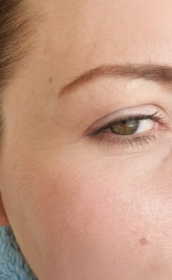 After 21 days of treatment